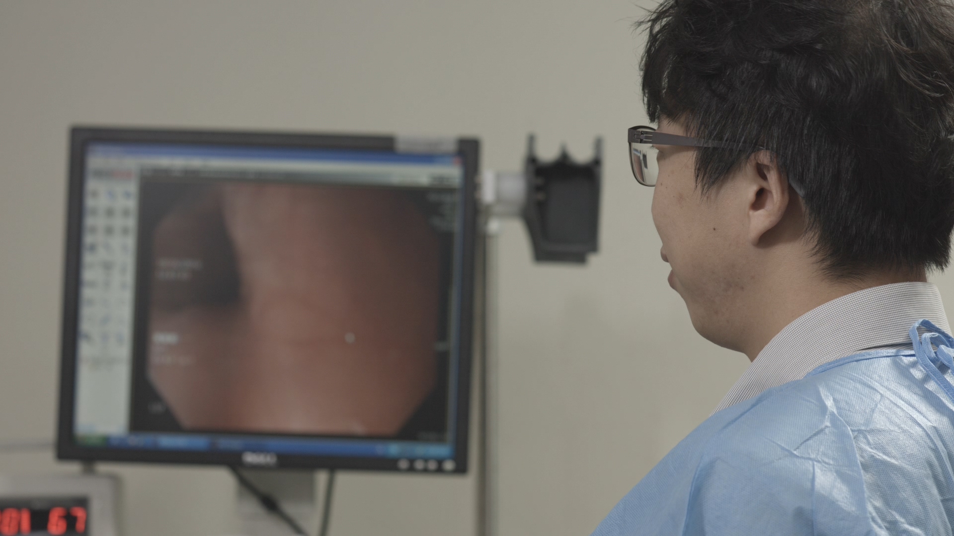 대장 내시경검사 (Colonoscopy) 첨부 이미지