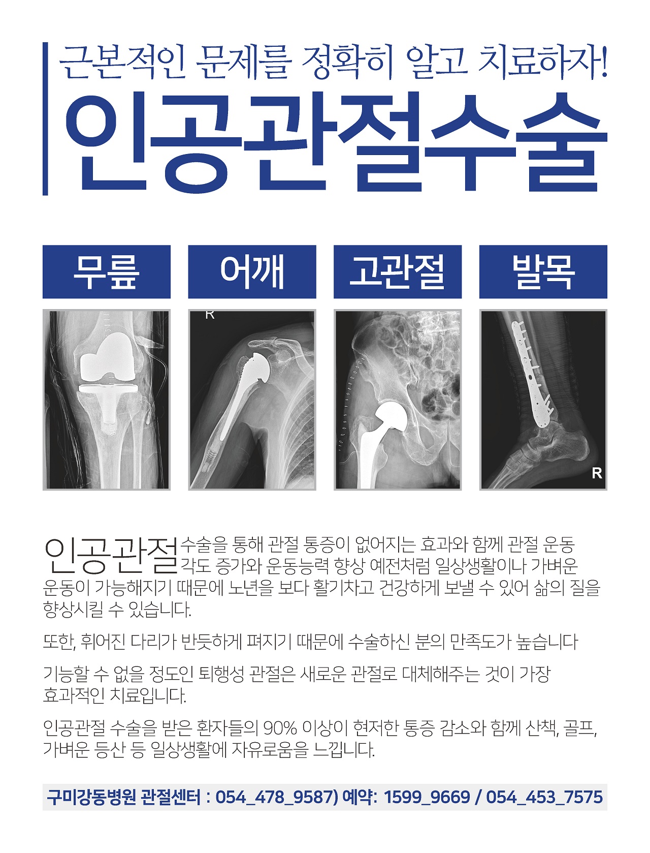 근본적인 문제를 정확히 알고 치료하자! 인공관절수술 첨부 이미지