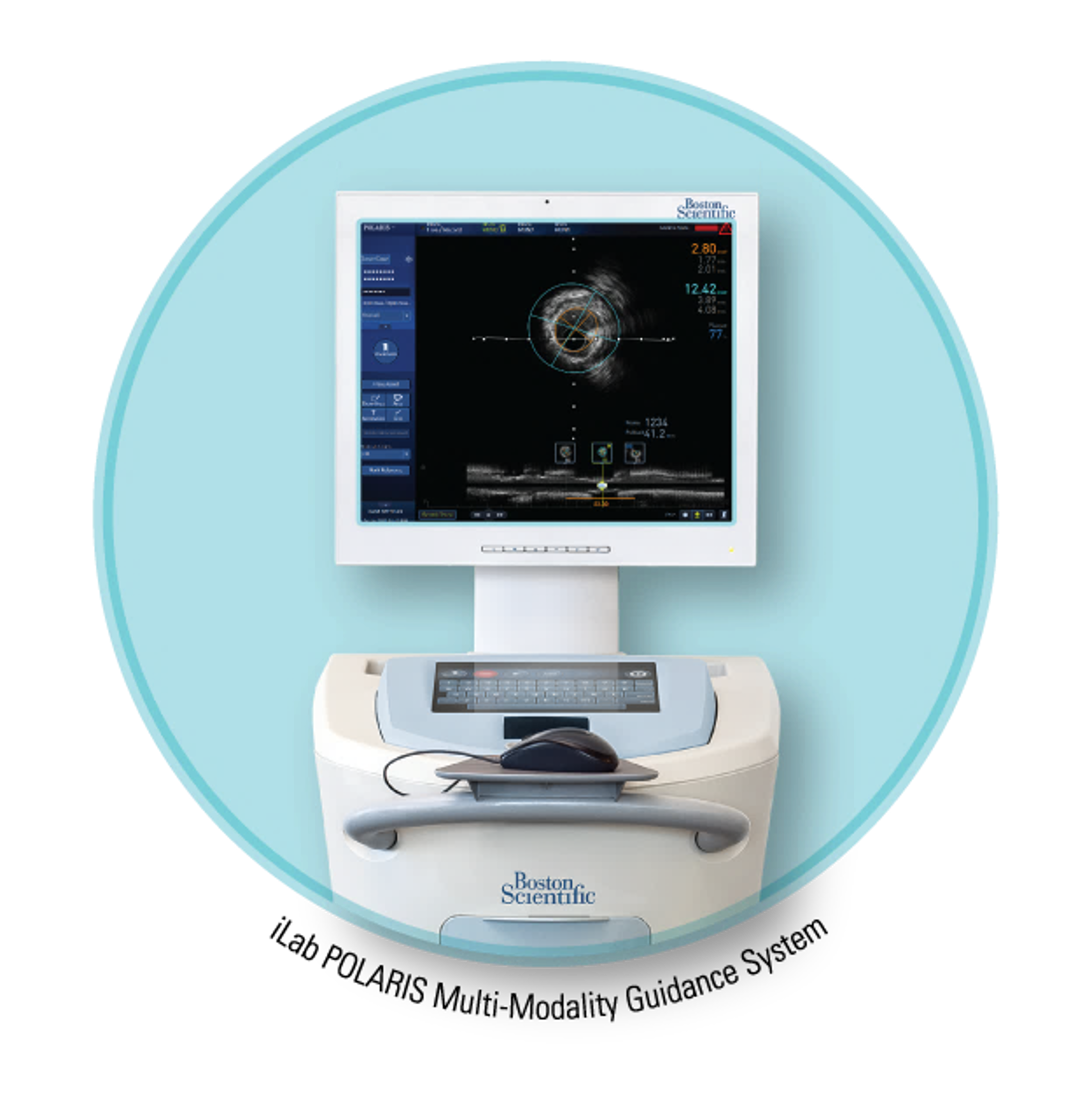 초음파영상 진단장치 : POLARIS IVUS (Boston Scientific Corporation) 첨부 이미지