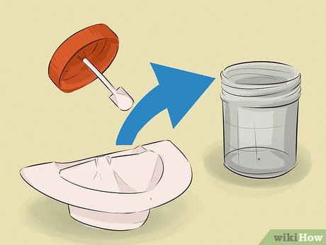 대변검사 (Stool exam) 첨부 이미지