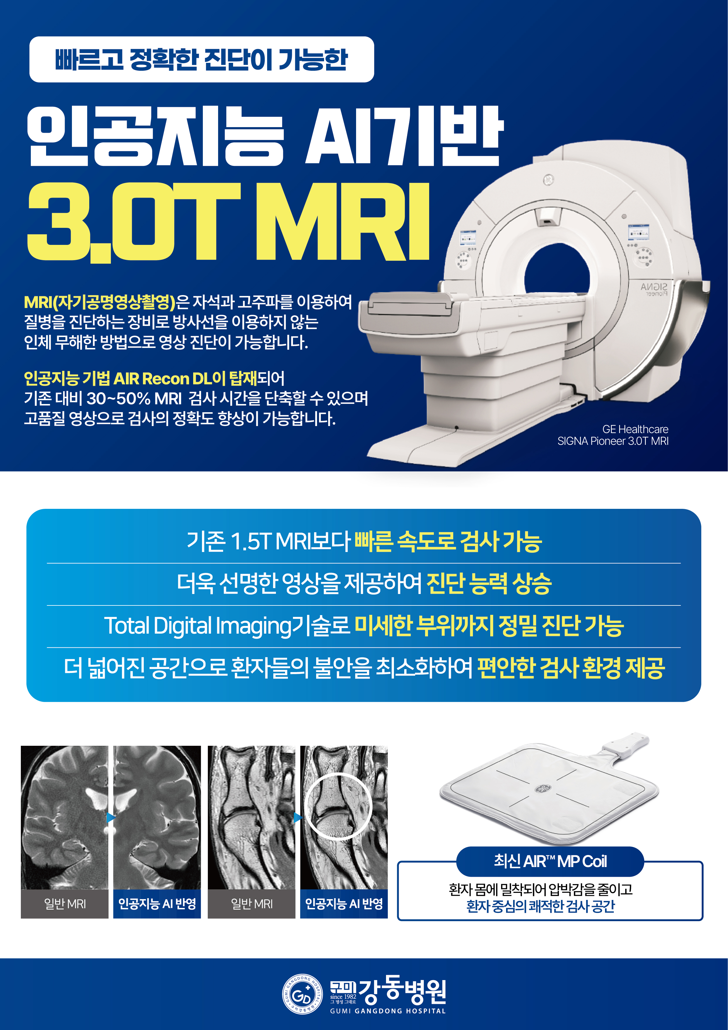 인공지능 AI 기반 MRI 3.0T SIGNA Pioneer (MRI:Magnetic Resonance Imaging) 첨부 이미지