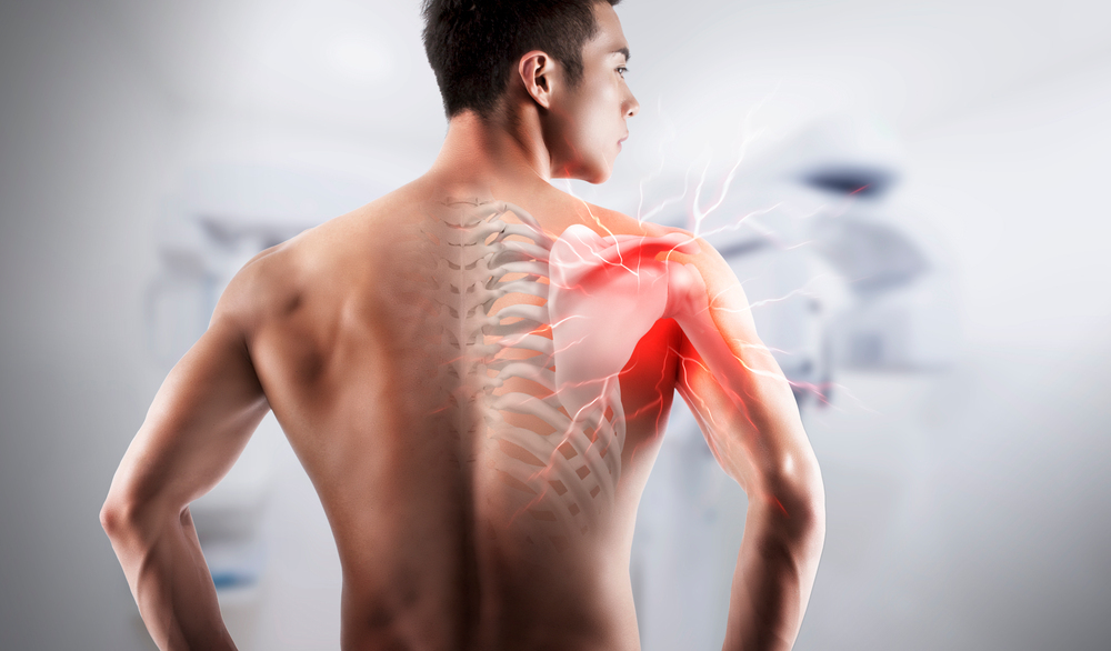 회전근개 증후군 : Rotator cuff syndrome 첨부 이미지