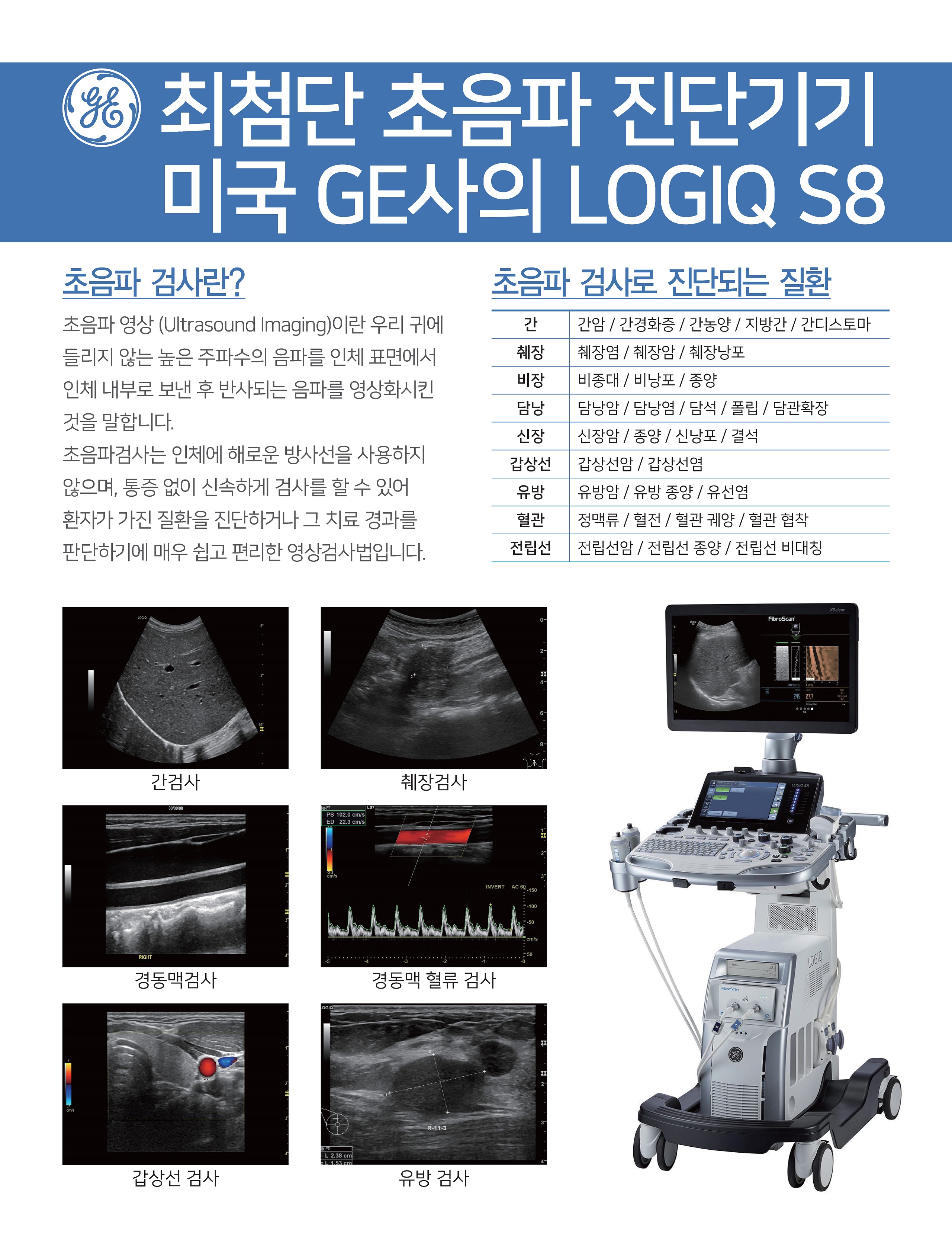상복부초음파 첨부 이미지