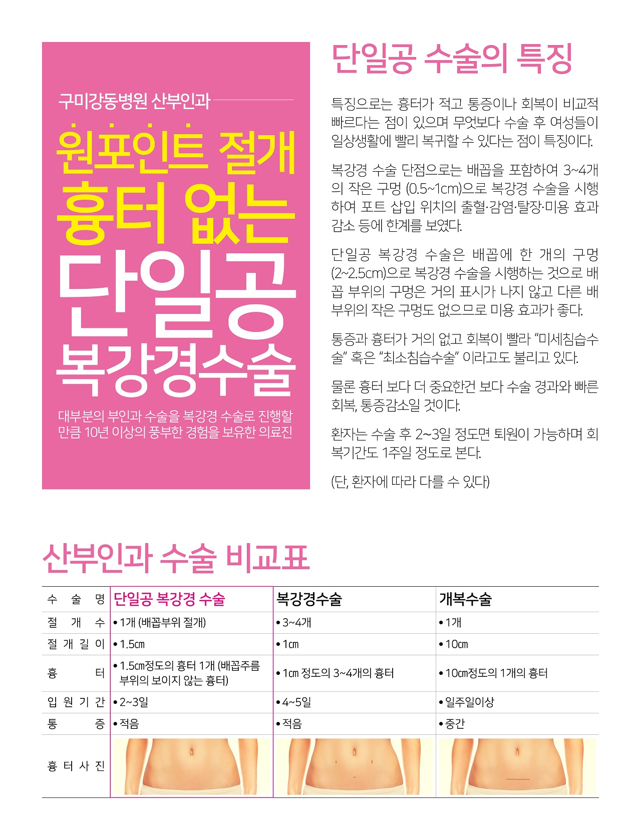 원포인트 절개- 흉터 없는 단일공 복강경수술 첨부 이미지